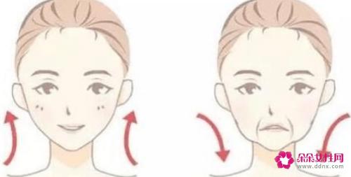 脸部重度下垂怎么办