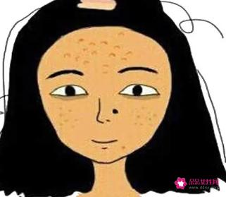 皮肤暗黄有色斑怎样调理