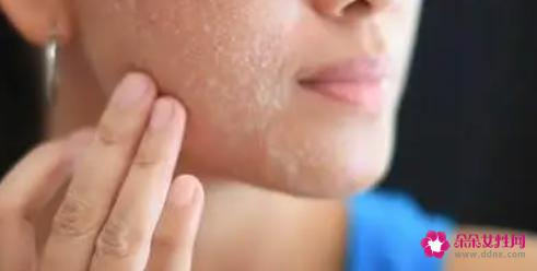 经常去角质好吗