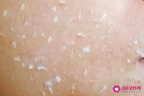 经常去角质好吗