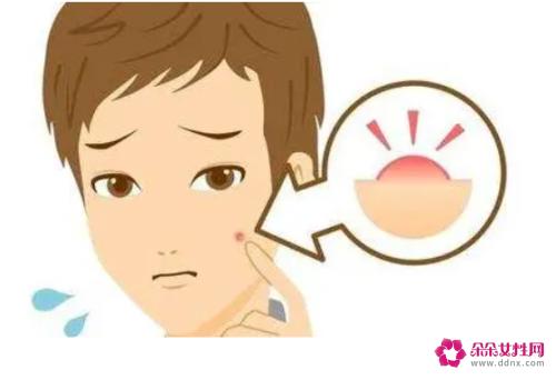男士祛痘美白面膜哪个好