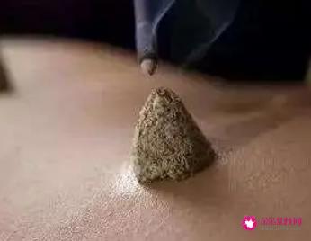 艾灸有减肥的功效吗