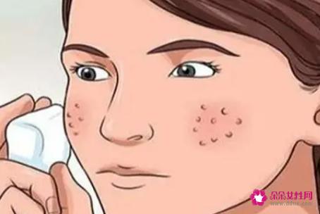 毛孔粗大的原因是哪些