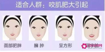 瘦脸针有没有副作用呢