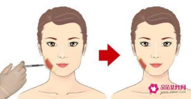 瘦脸针有没有副作用呢