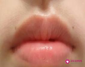 怎么去小胡子