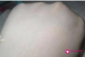 肌肤纹理是什么