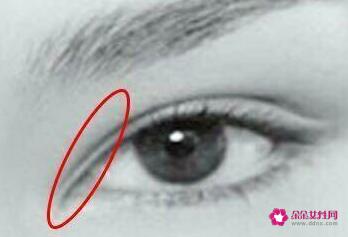 4种双眼皮类型图片