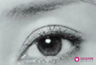 4种双眼皮类型图片