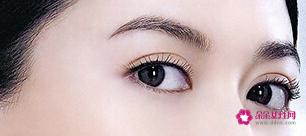 女生到底该不该去割双眼皮