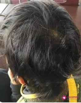 女婴发型图短发夏季