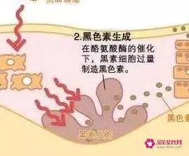 色素斑是怎么形成的呢
