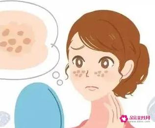 色素斑是怎么形成的呢