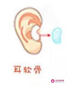 耳软骨隆鼻的利弊