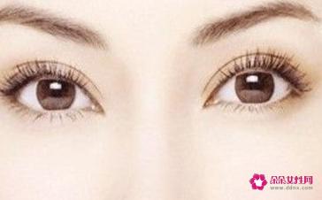 双眼皮有几种种类