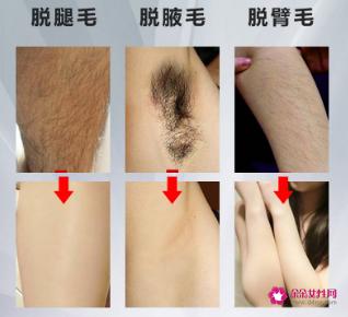 女生说脱毛是指哪里