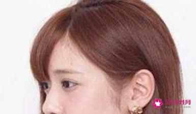 额头高的女生适合什么发型