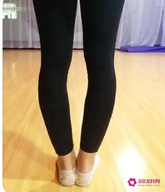 o型腿穿什么裤子比较好