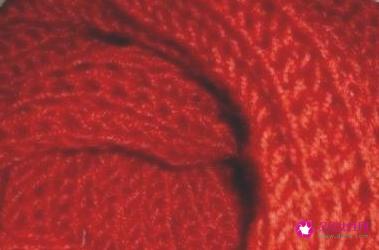 粗线围巾的各种织法