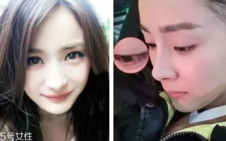 内双怎么进化成双眼皮？全是双眼皮贴的功劳