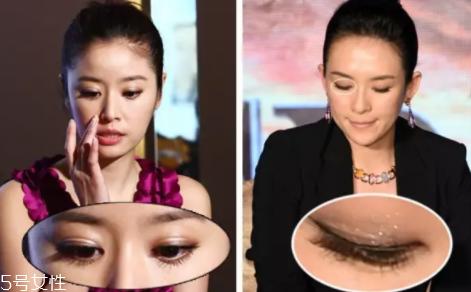 内双怎么进化成双眼皮？全是双眼皮贴的功劳