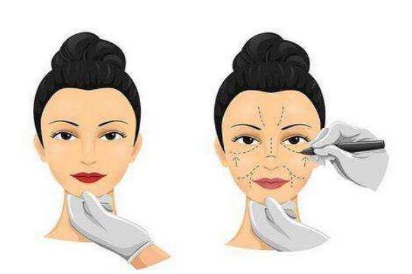 电波拉皮的多少钱一次呢 电波拉皮一次可以持续多久呢