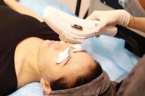 光子嫩肤一般多少钱一次 光子嫩肤的功效与作用