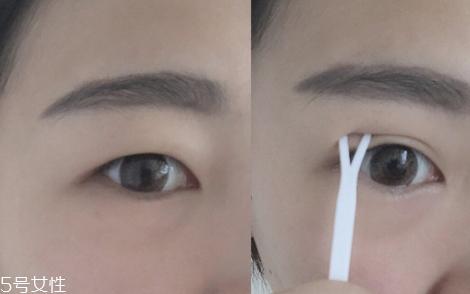双眼皮贴一般多少钱?