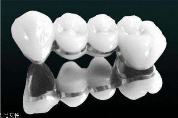 哪些人不适合做烤瓷牙 做烤瓷牙后牙齿还能矫正吗