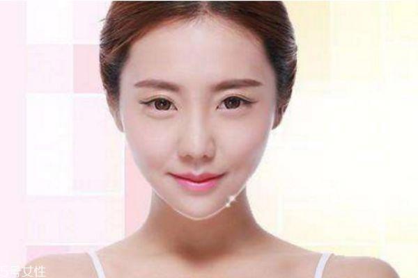 垫下巴多久可以恢复 垫下巴后多久可以吃饭