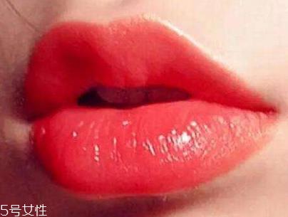 唇珠是什么 玻尿酸丰唇珠效果好吗