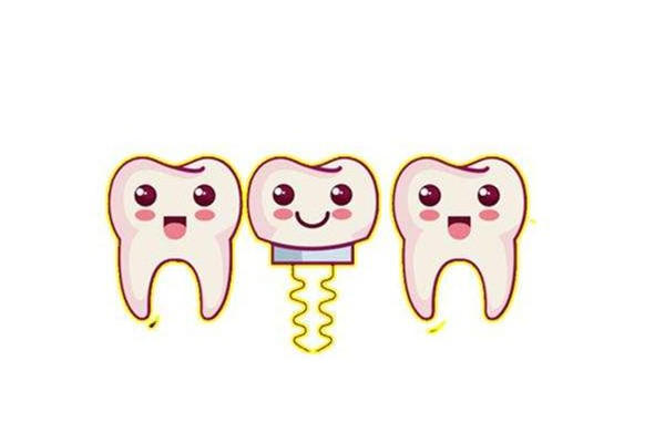 种牙去医院还是口腔诊所 种牙去私立好还是公立好