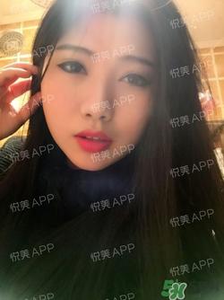 切开双眼皮消肿过程图_切开双眼皮恢复过程图