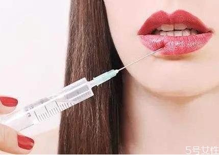 嘴唇打玻尿酸好不好 玻尿酸丰唇几天最好看