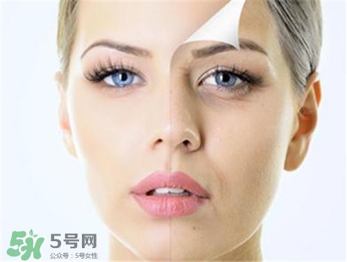 玻尿酸除皱有效果吗?玻尿酸除皱效果怎么样?