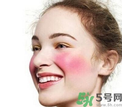 敏感性皮肤用什么洗面奶?敏感性皮肤怎么修复?