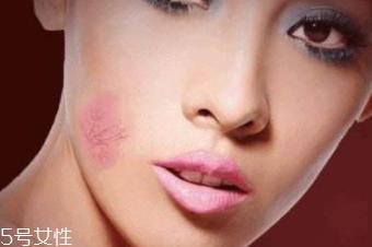 红血丝用哪种护肤品？6款大牌全面对抗红血丝