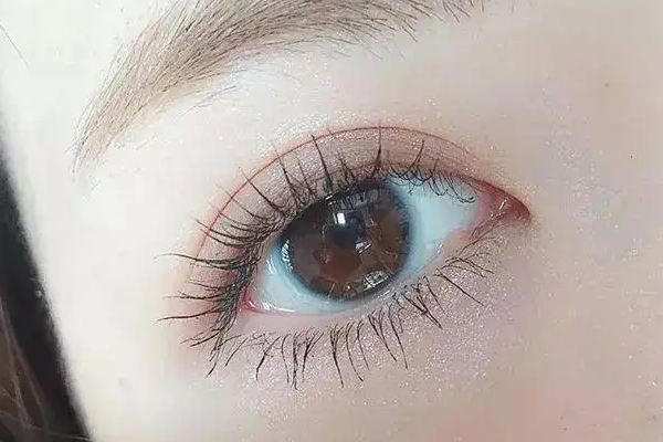 武汉双眼皮整形最好医院排名 武汉双眼皮整形要花多少费用