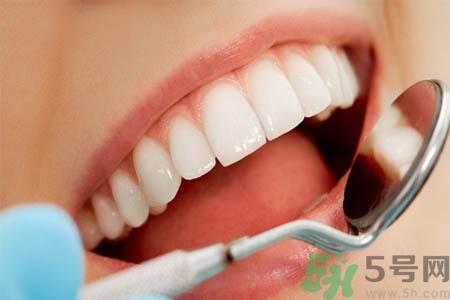 冷光美白牙齿的价格是多少?做冷光美白牙齿需要多少钱?