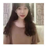 开内眼角要多久恢复 依个人体质而定