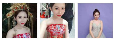 开内眼角要多久恢复 依个人体质而定