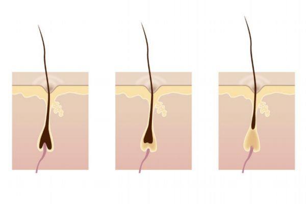 激光脱毛后还会长吗 激光脱毛能坚持几年