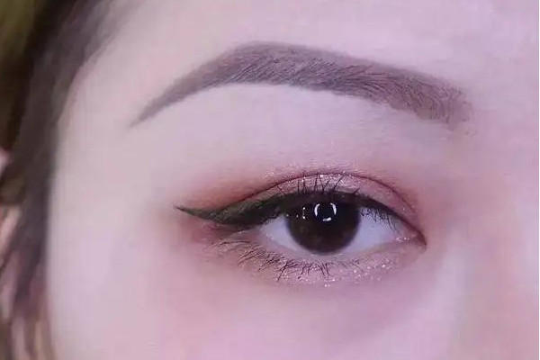 武汉激光洗眉毛的医院推荐 武汉激光洗眉毛一般要多少钱