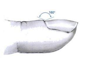 指甲上有白点是怎么回事？指甲上有白色斑点怎么办？