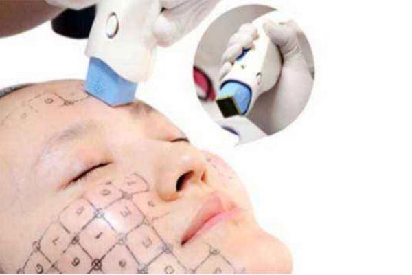 热玛吉四代和热玛吉五代的区别 选四代还是五代热玛吉