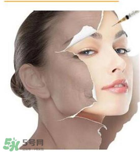 美白针安全吗?美白针可以自己注射吗?