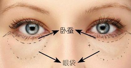 卧蚕和眼袋的区别图片 7招小技巧掩盖