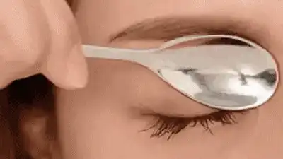 卧蚕和眼袋的区别图片 7招小技巧掩盖