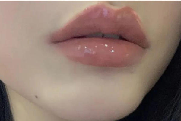 丰唇大概要多少钱 丰唇有哪些方法