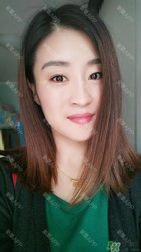 埋线双眼皮能保持多久?埋线双眼皮是永久吗